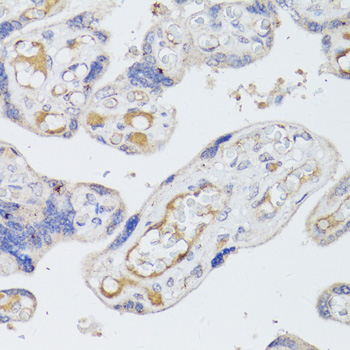 BMPR2 Polyclonal Antibody