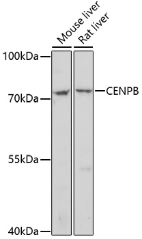 CENPB Polyclonal Antibody