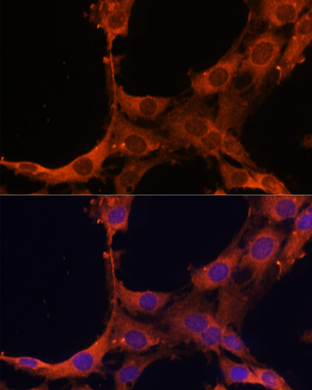 SMAD2/SMAD3 Polyclonal Antibody