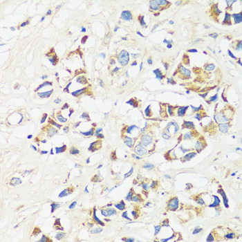 CADPS Polyclonal Antibody