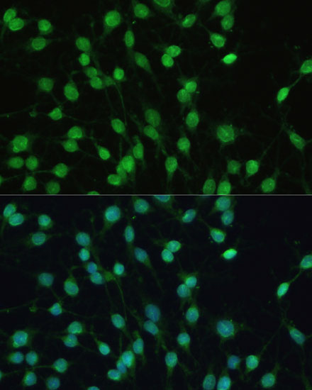 PXR Polyclonal Antibody
