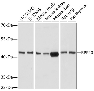 RPP40 Polyclonal Antibody