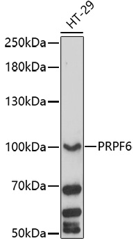 PRPF6 Polyclonal Antibody