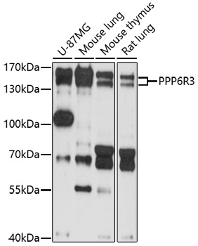 PPP6R3 Polyclonal Antibody