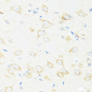 ASIC4 Polyclonal Antibody