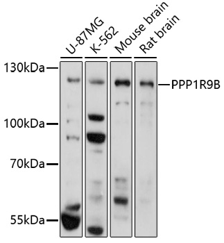 PPP1R9B Polyclonal Antibody