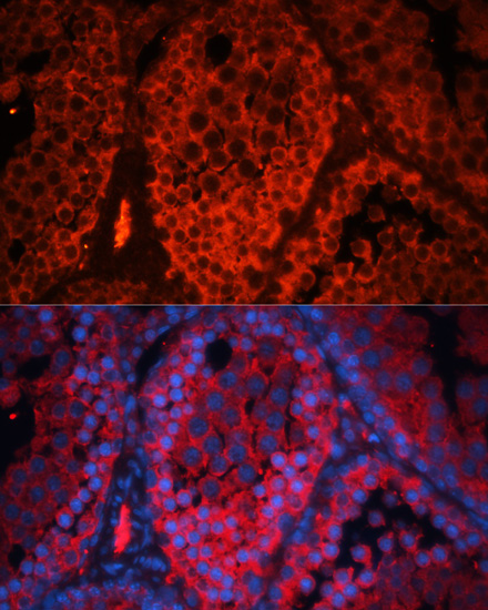 Kctd19 Polyclonal Antibody
