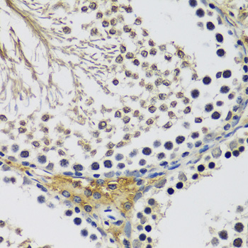 C10orf62 Polyclonal Antibody