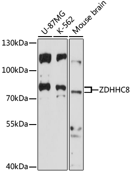 ZDHHC8 Polyclonal Antibody
