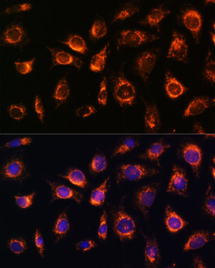 RAB1A Polyclonal Antibody