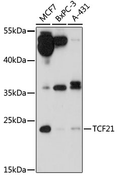 TCF21 Polyclonal Antibody