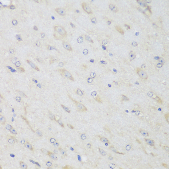 CLCN6 Polyclonal Antibody