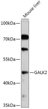 GALK2 Polyclonal Antibody