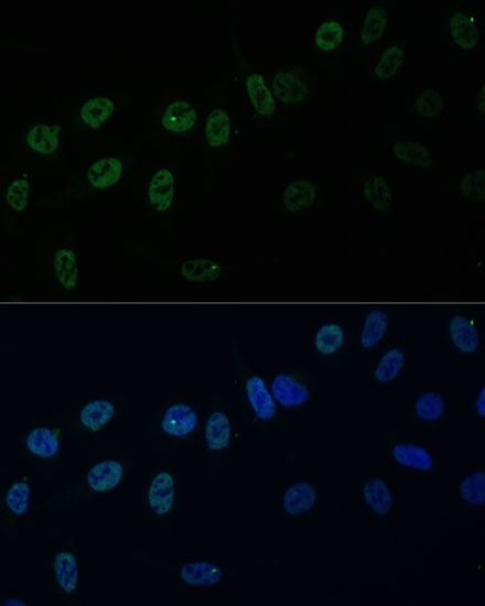 HNRPAB Polyclonal Antibody