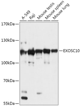 EXOSC10 Polyclonal Antibody