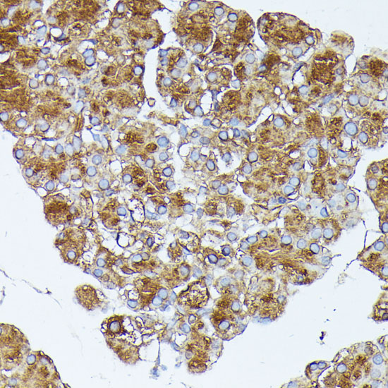 PNLIPRP1 Polyclonal Antibody