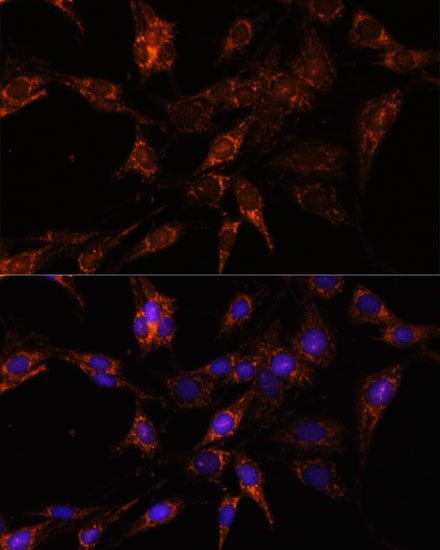 TBCC Polyclonal Antibody