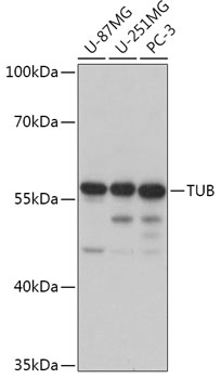 TUB Polyclonal Antibody