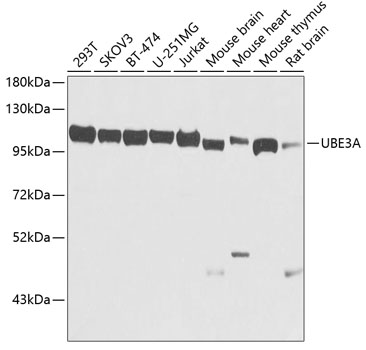 UBE3A Polyclonal Antibody