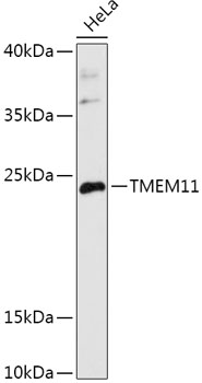 TMEM11 Polyclonal Antibody
