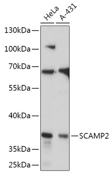 SCAMP2 Polyclonal Antibody