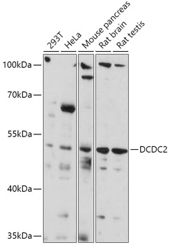 DCDC2 Polyclonal Antibody