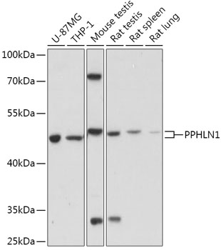 PPHLN1 Polyclonal Antibody