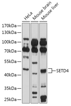 SETD4 Polyclonal Antibody