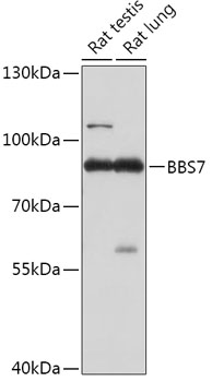 BBS7 Polyclonal Antibody