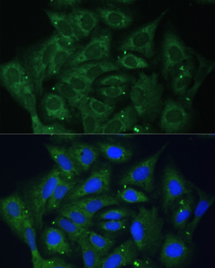 IGF2BP2 Rabbit Polyclonal Antibody