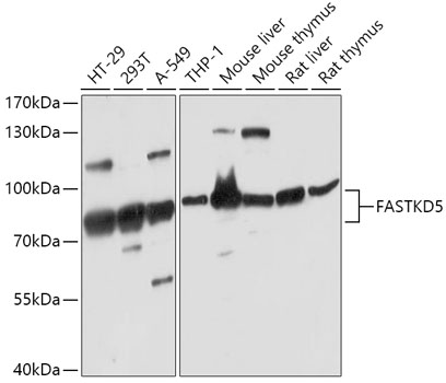 FASTKD5 Rabbit Polyclonal Antibody