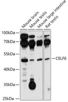 CELF6 Polyclonal Antibody