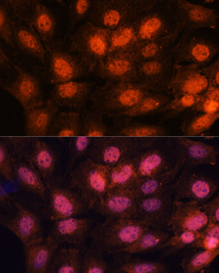 CHTF18 Polyclonal Antibody