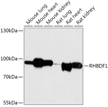 RHBDF1 Polyclonal Antibody