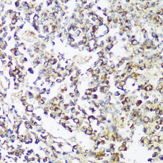 FNDC4 Polyclonal Antibody