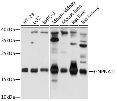 GNPNAT1 Polyclonal Antibody
