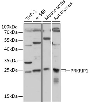 PRKRIP1 Polyclonal Antibody