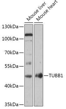 TUBB1 Polyclonal Antibody