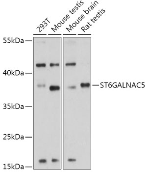 ST6GALNAC5 Polyclonal Antibody