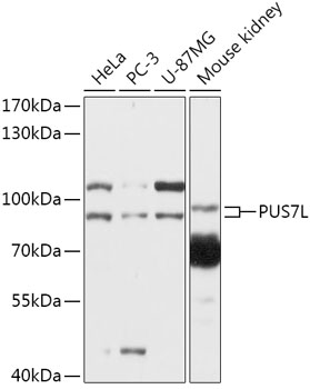 PUS7L Polyclonal Antibody