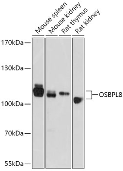 OSBPL8 Polyclonal Antibody
