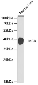 RAGE antibody
