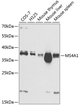 MS4A1 antibody