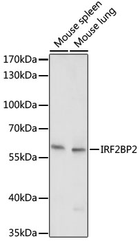 IRF2BP2 Polyclonal Antibody