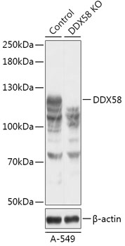 DDX58 Polyclonal Antibody
