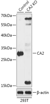 CA2 Polyclonal Antibody