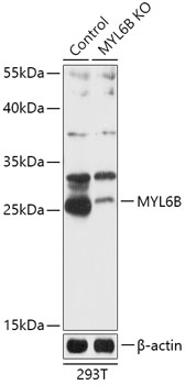 MYL6B Polyclonal Antibody
