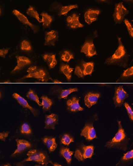 OBSCN Polyclonal Antibody