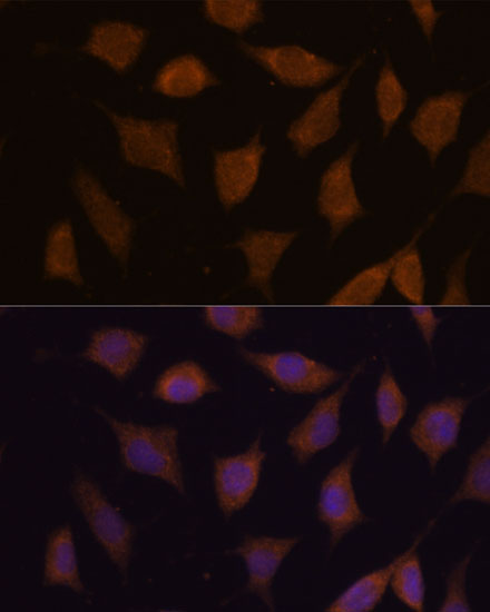 FBXW8 Polyclonal Antibody