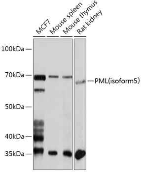 PML(isoform 5) Polyclonal Antibody